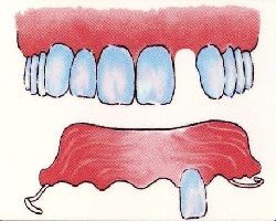 Miford Dentist Denture Example