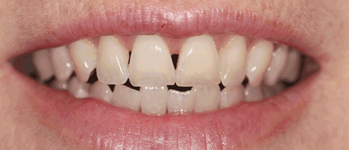 Milford Dentist Dental Gallery Images