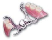 Chrome Cobalt or Titanium denture Milford Dentists