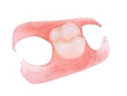 Valplast Dentures
