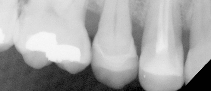 Milford Dentist Digital xray