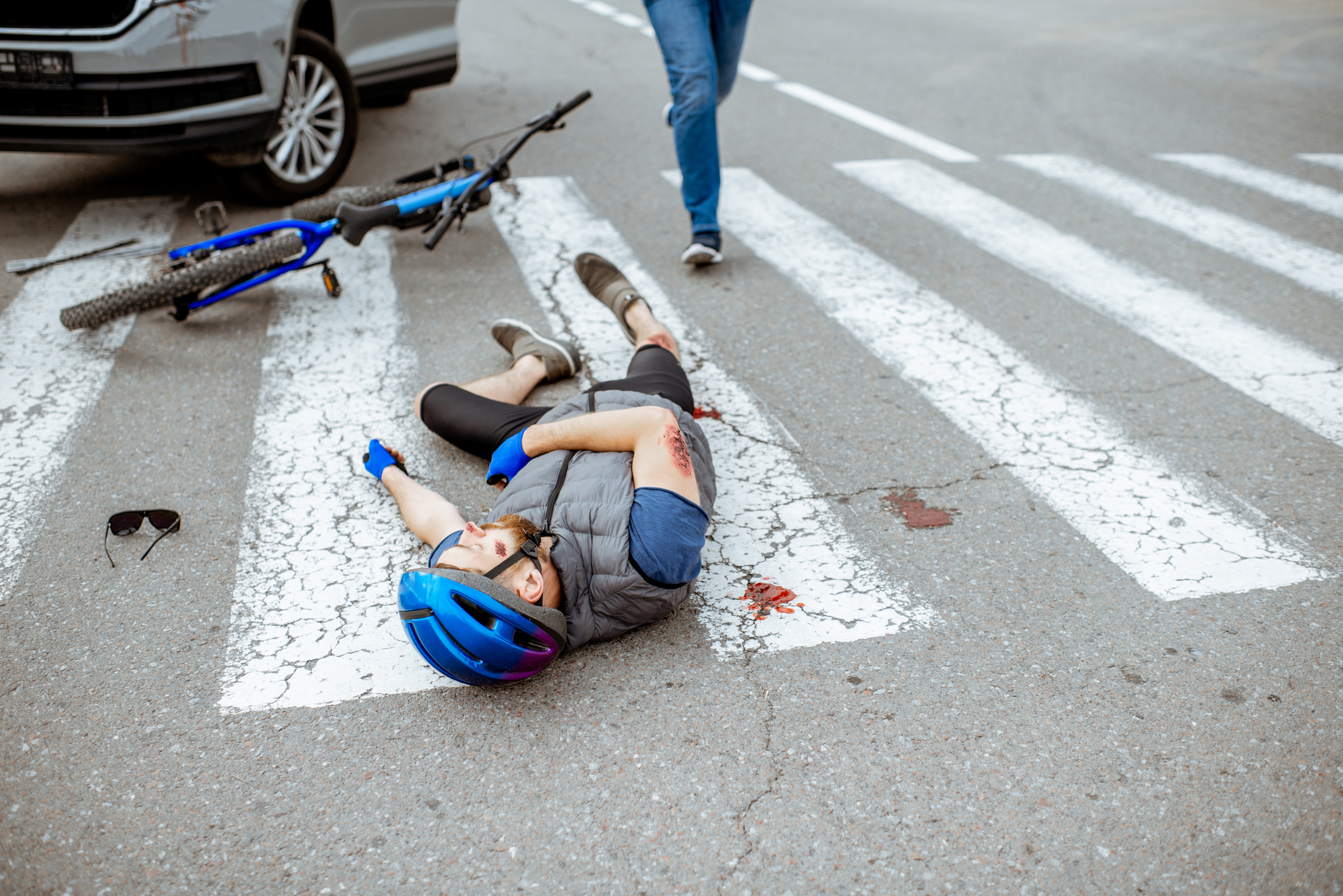 Abogado para lesiones por atropello en bicicleta o choque con scooter eléctrico